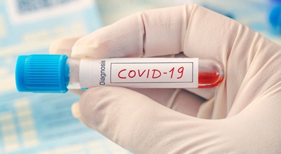 Unione dei Comuni Parte Montis-Test sierologici rapidi per Covid-19